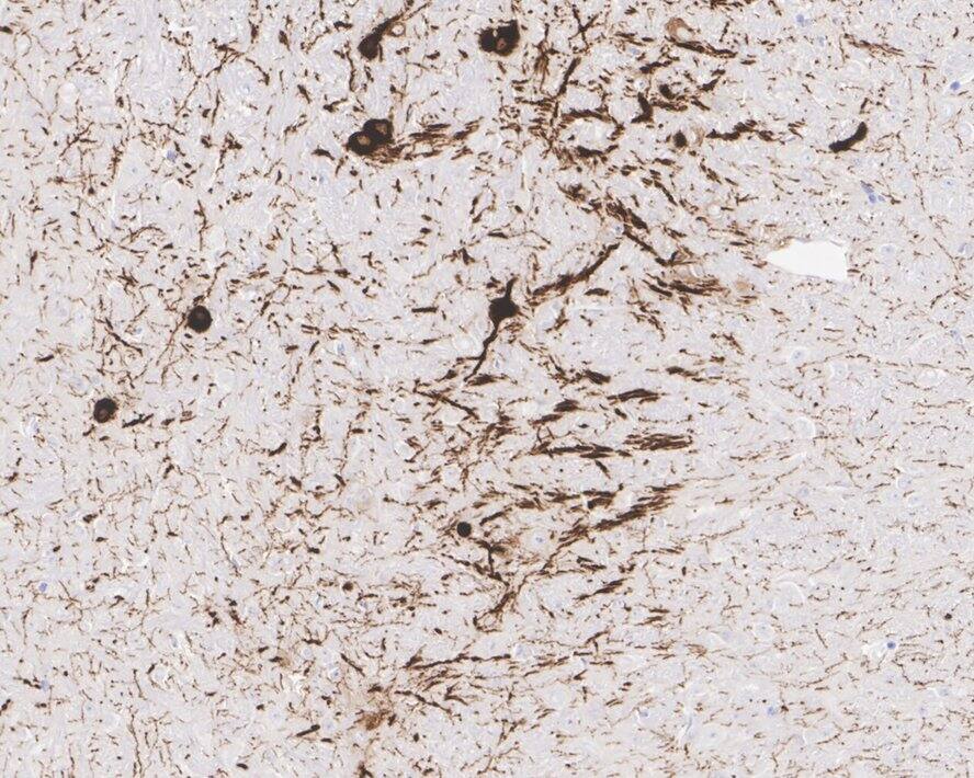 Tryptophan hydroxylase 2 Antibody (PSH04-89)