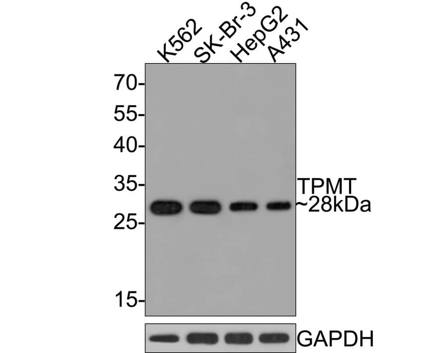 TPMT Antibody (JE64-09)