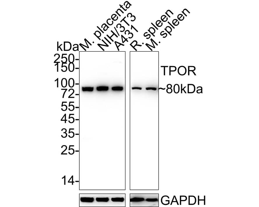 Thrombopoietin R/Tpo R Antibody (JE58-00) Western Blot: Thrombopoietin R/Tpo R Antibody (JE58-00) [NBP3-33039]