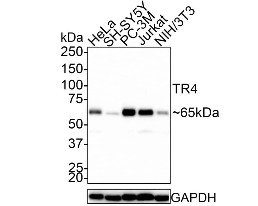 TR4/NR2C2 Antibody (JE45-03)