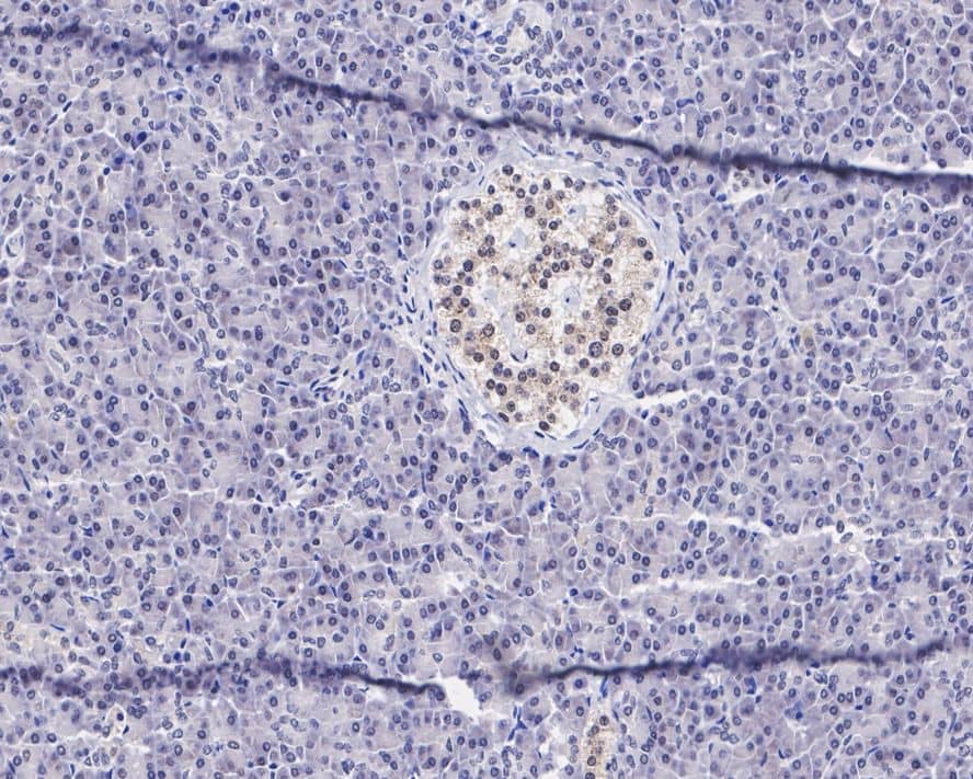 TR4/NR2C2 Antibody (JE45-03)