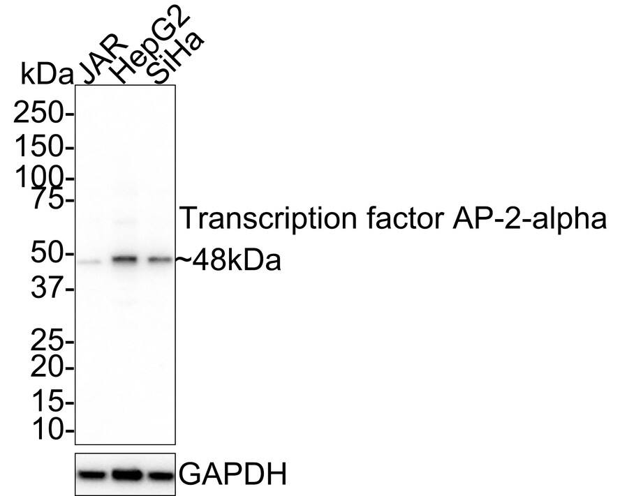 AP2 alpha Antibody (PSH02-05) Western Blot: AP2 alpha Antibody (PSH02-05) [NBP3-33043]