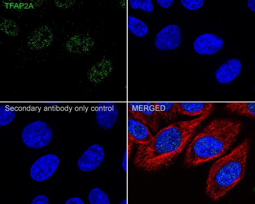 AP2 alpha Antibody (PSH02-05)
