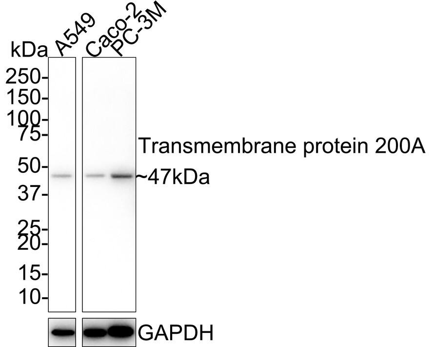 TMEM200A Antibody (4-B3-R) Western Blot: TMEM200A Antibody (4-B3-R) [NBP3-33045]