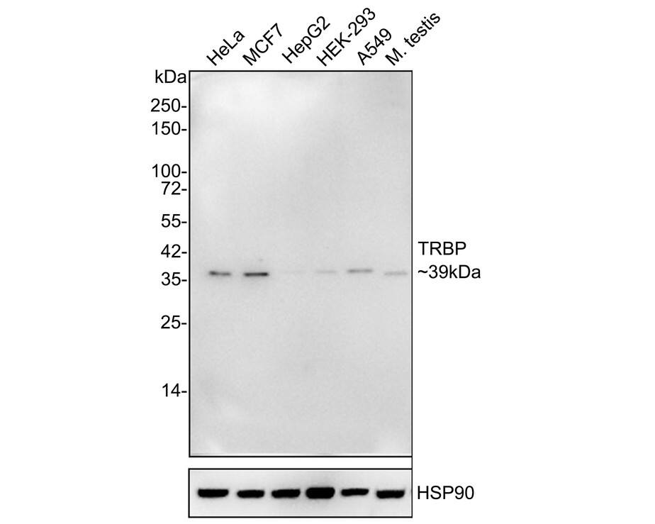 TRBP Antibody (JE34-99)