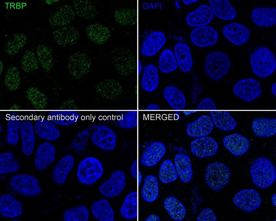TRBP Antibody (JE34-99)