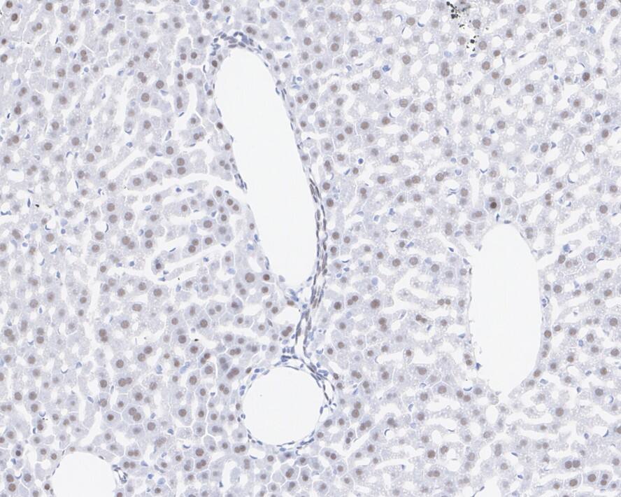 TRBP Antibody (JE34-99)