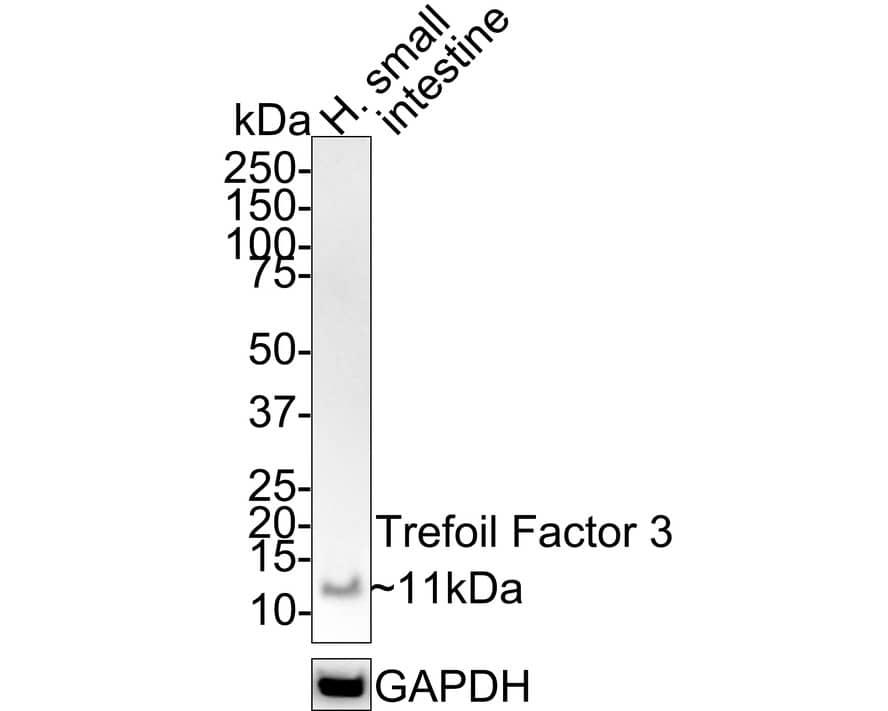 TFF3 Antibody (JE32-01)