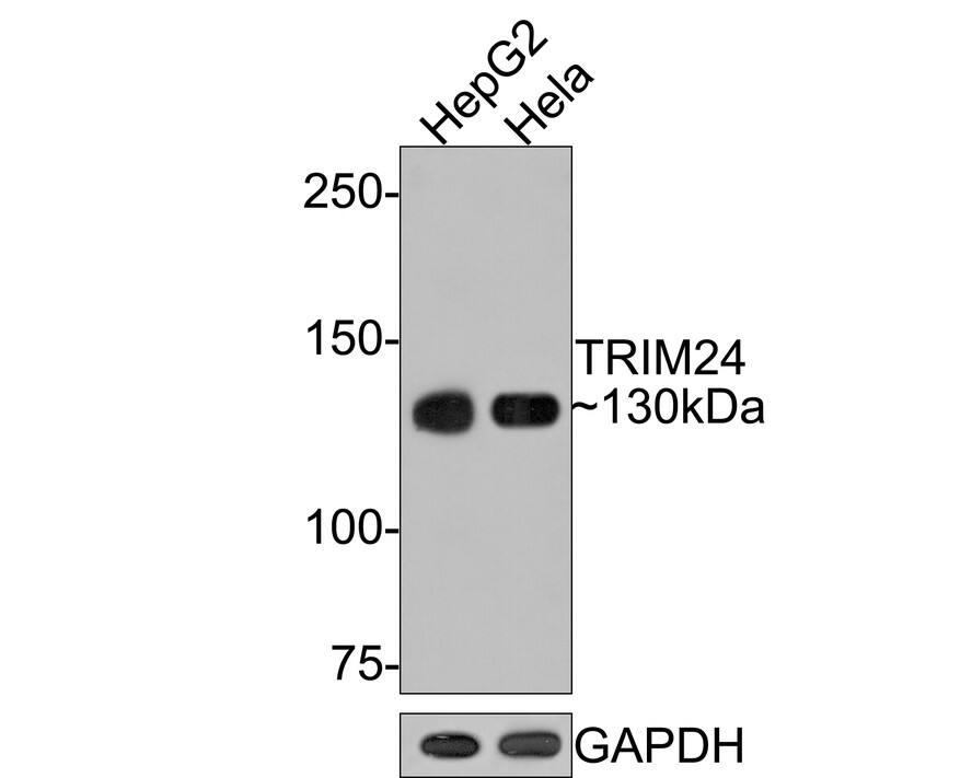 TIF1 alpha Antibody (JE64-31)