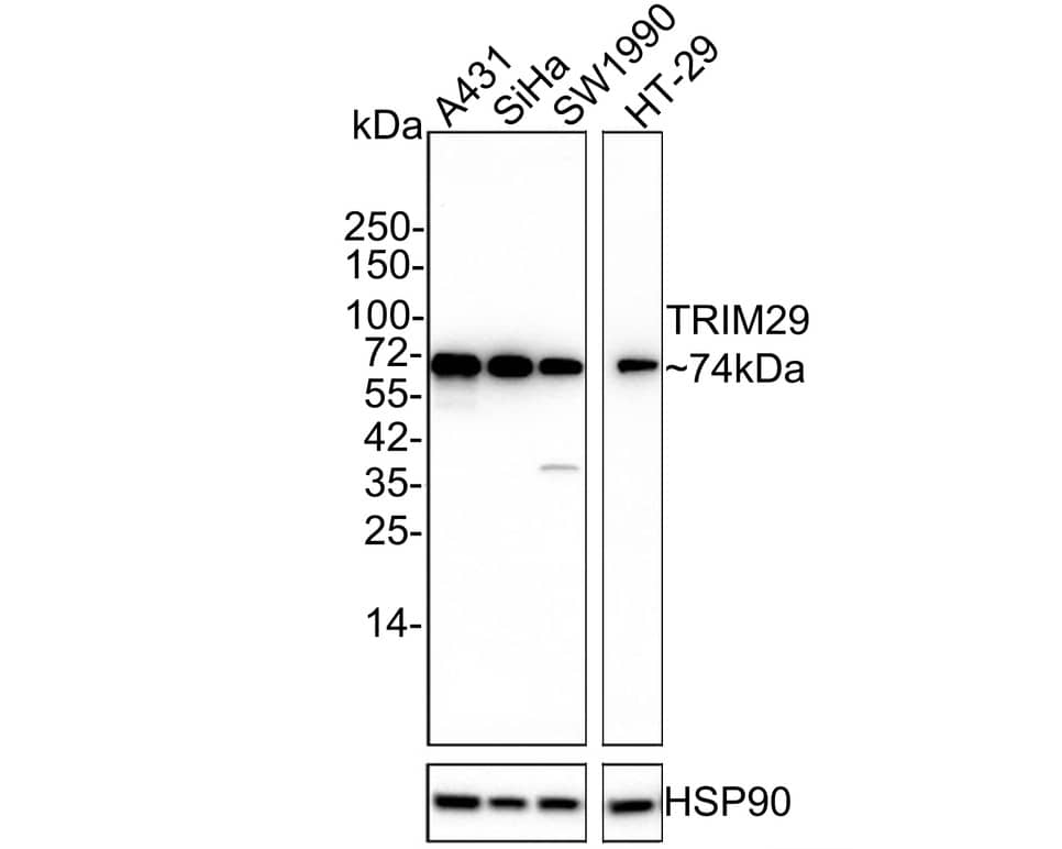 TRIM29 Antibody (PSH02-99)