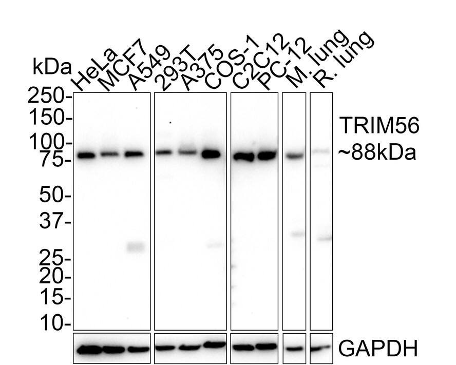 TRIM56 Antibody (PSH02-17)