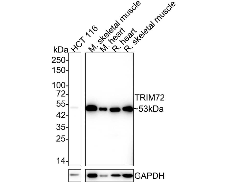 TRIM72 Antibody (A1D4-R)