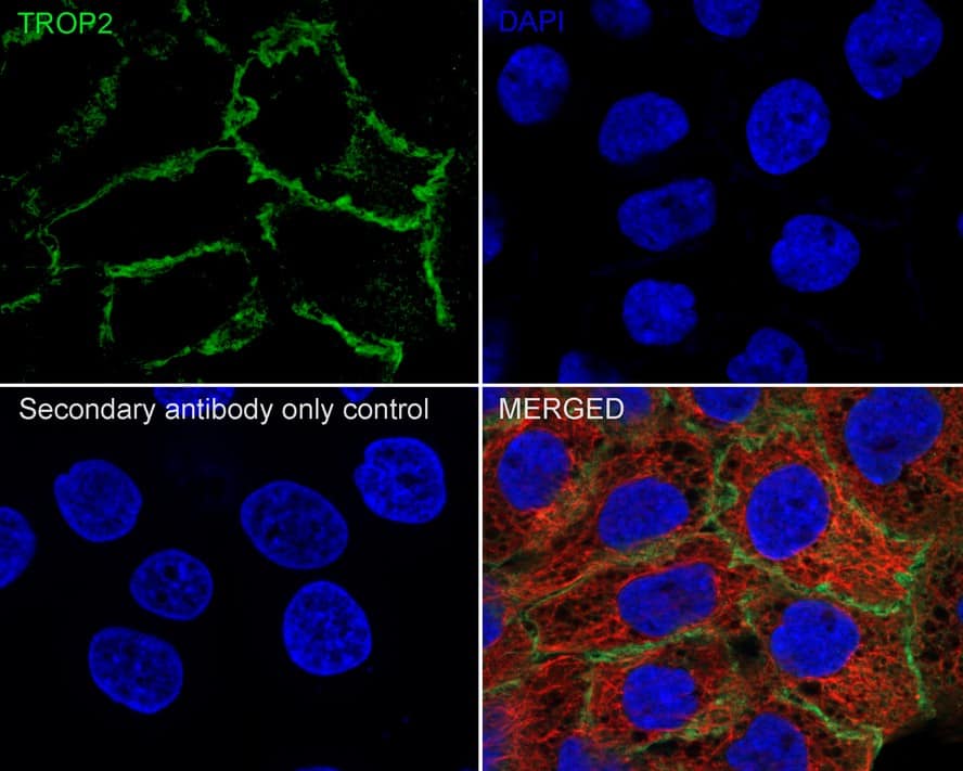 TROP-2 Antibody (A10G7-R)