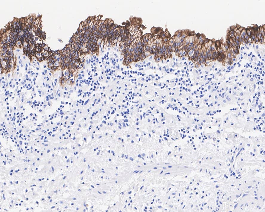 TROP-2 Antibody (A10G7-R)