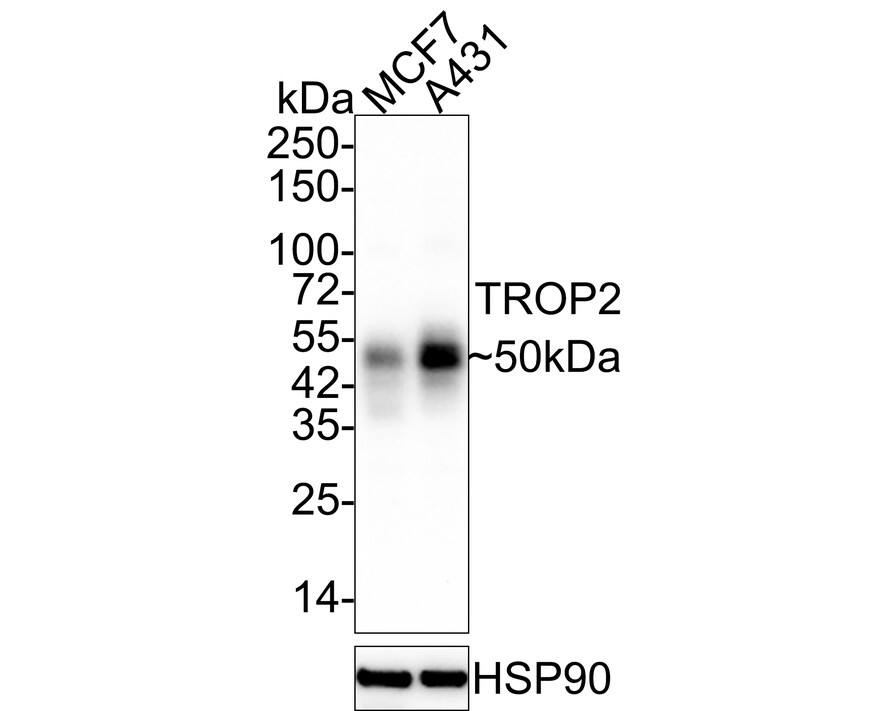 TROP-2 Antibody (A5E2-R)