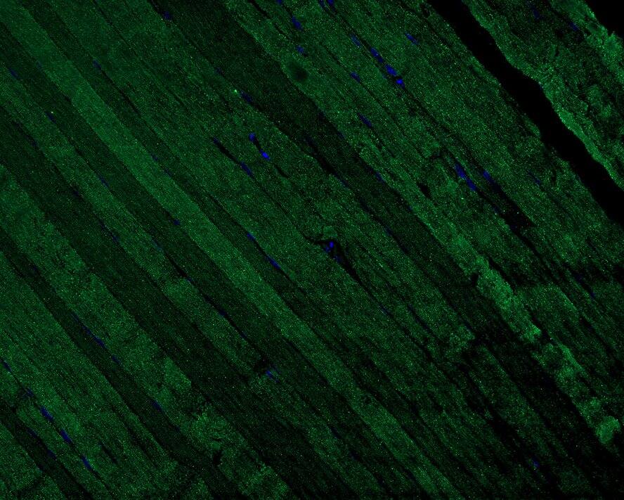 tropomyosin-2 Antibody (PSH02-63)