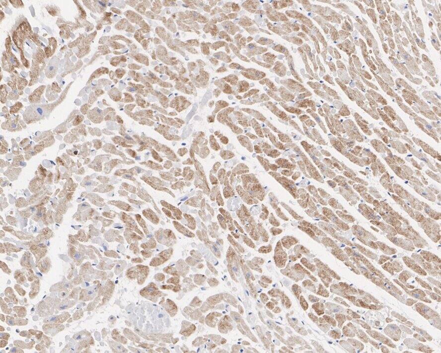 tropomyosin-2 Antibody (PSH02-63)