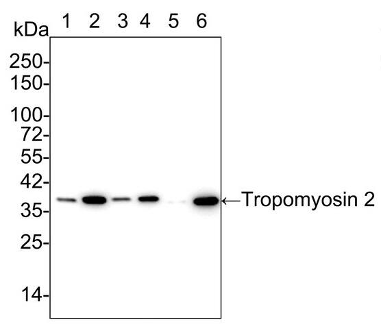 tropomyosin-2 Antibody (PSH02-63)