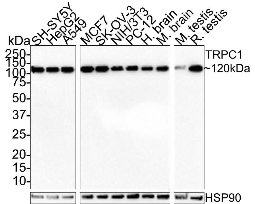 TRPC1 Antibody (JE35-25)