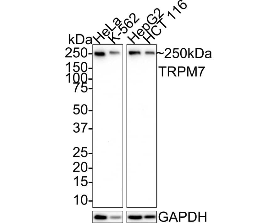 TRPM7 Antibody (JE38-36)