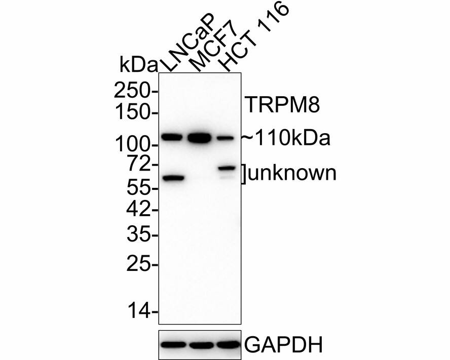 TRPM8 Antibody (JE32-58)