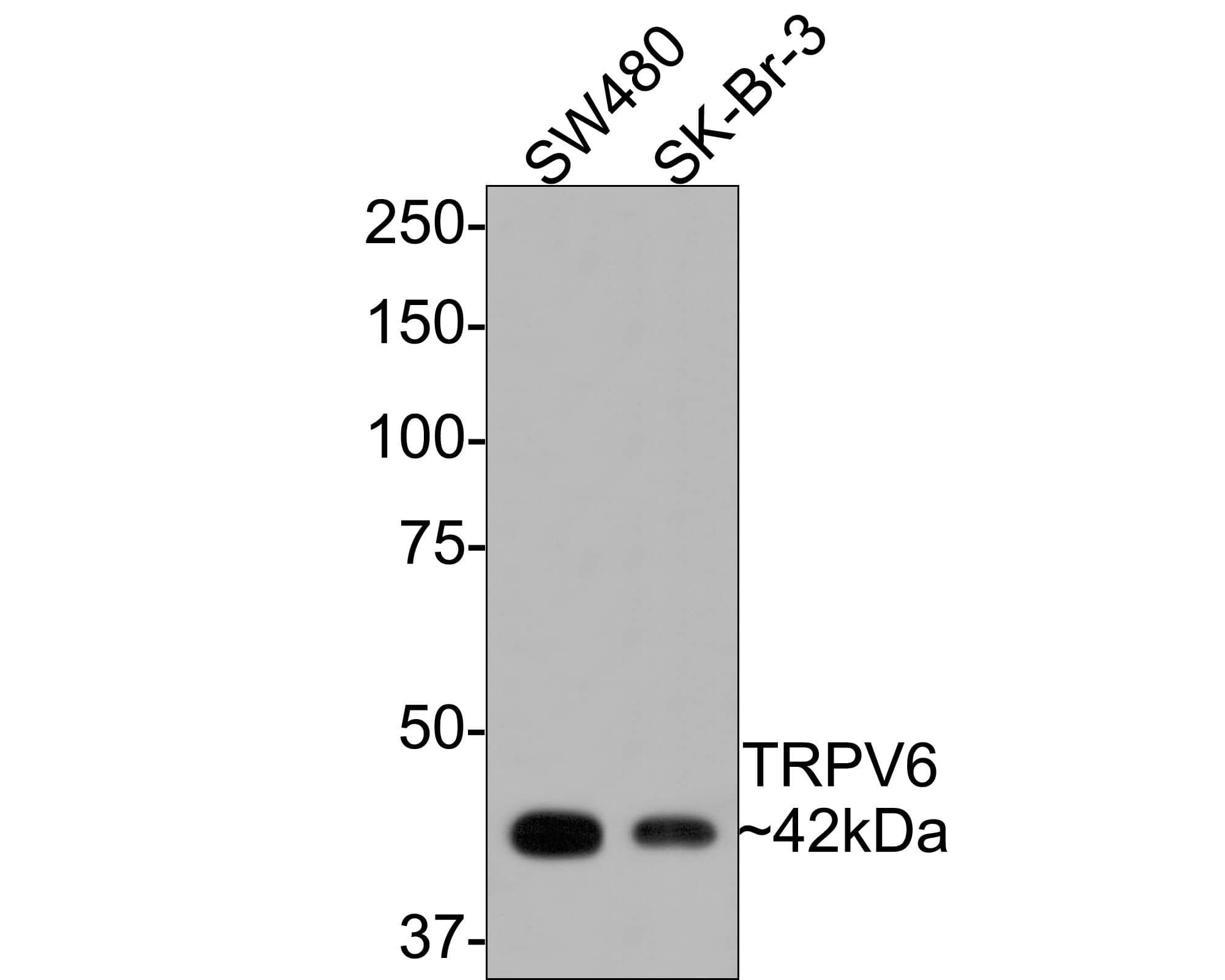 TRPV6 Antibody