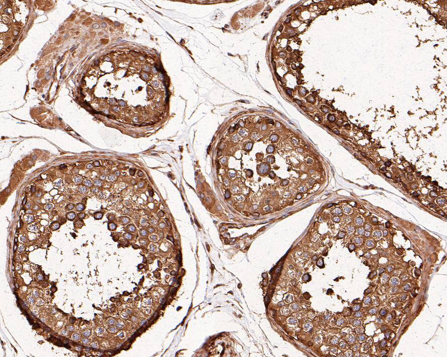 alpha Tubulin 3c Antibody (PSH0-14)