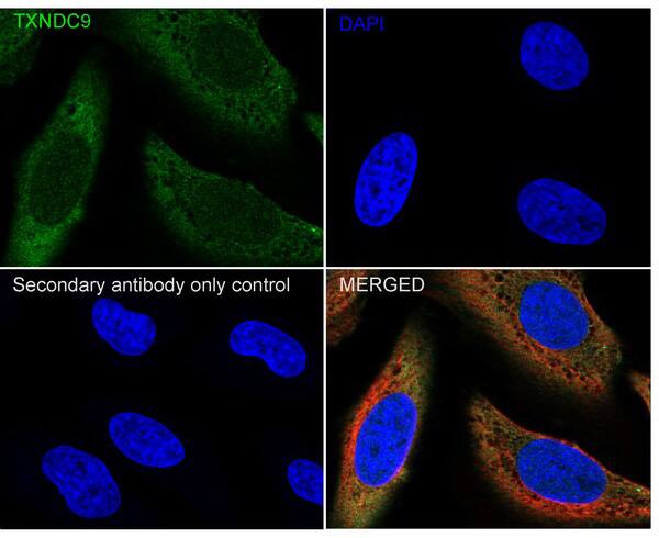 TXNDC9 Antibody (PSH04-43)