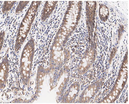 TXNDC9 Antibody (PSH04-43)