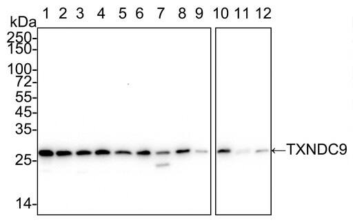 TXNDC9 Antibody (PSH04-43)