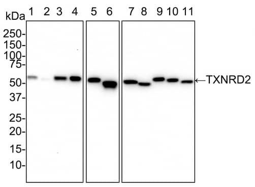 TXNRD2 Antibody (PSH02-26)