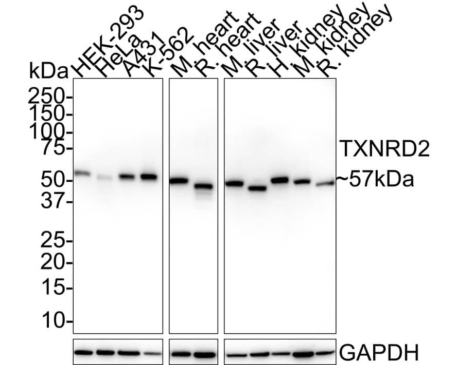 TXNRD2 Antibody (PSH02-27)