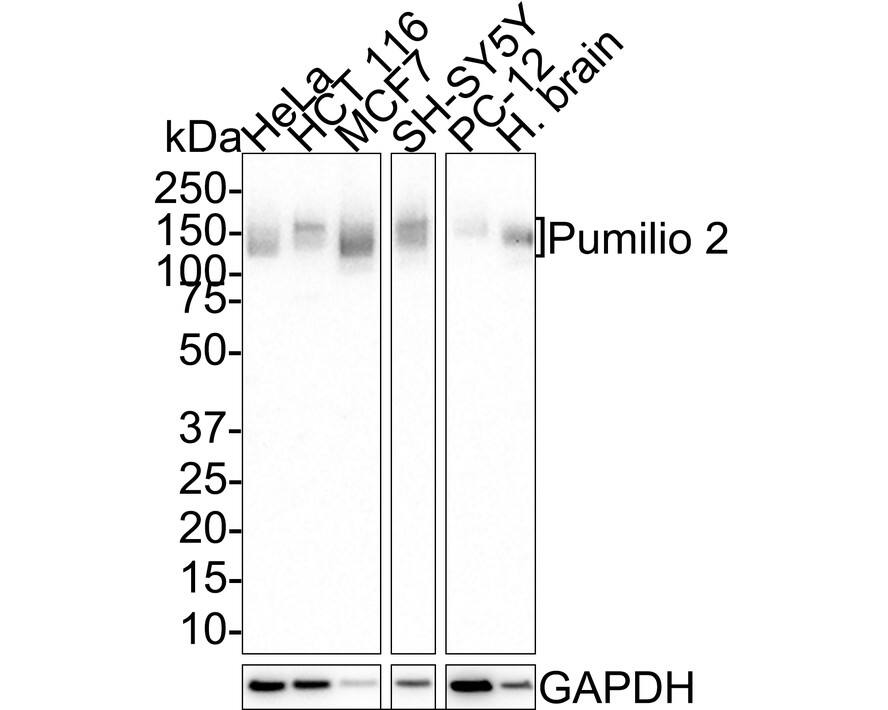 Dtk/TYRO3 Antibody (JE38-13)