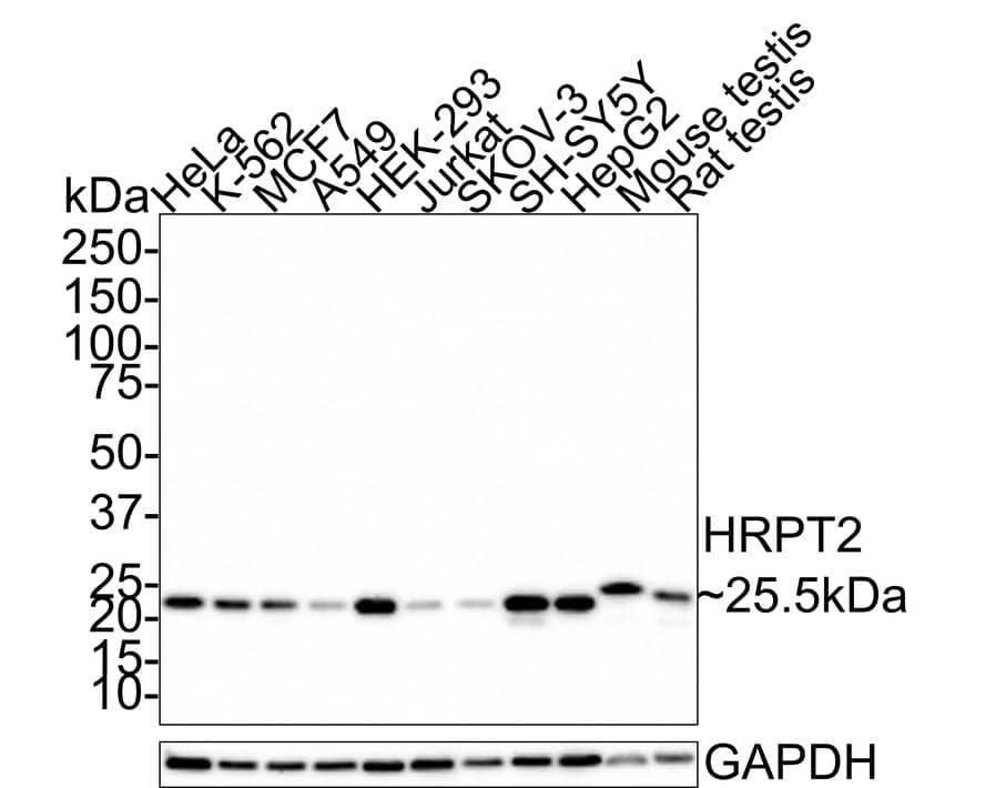 UBE2T Antibody (JE65-79)