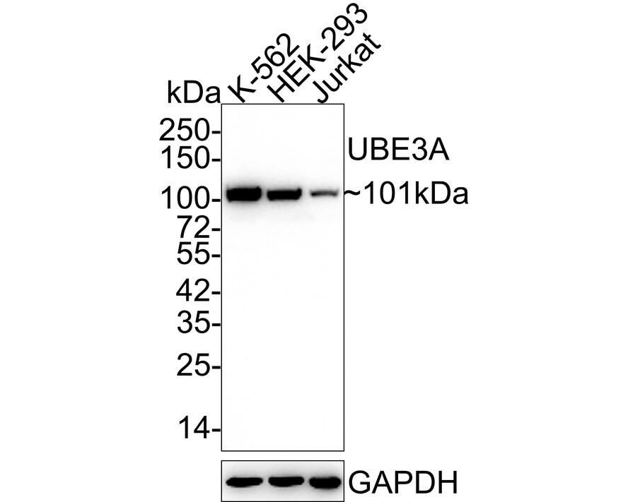 E6AP/UBE3A Antibody (JE32-48)