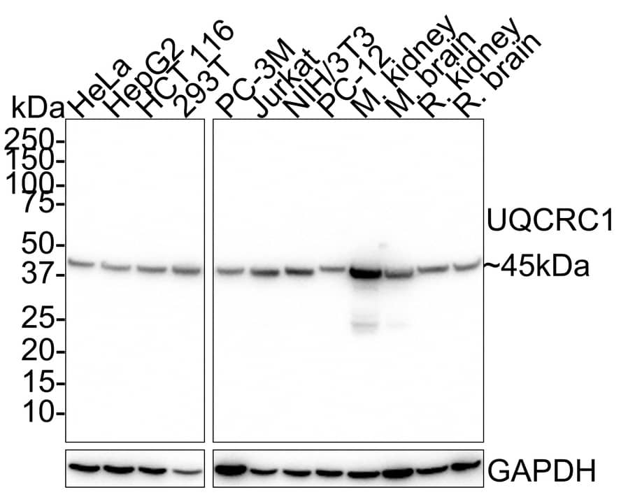 UQCRC1 Antibody (PSH01-23) Western Blot: UQCRC1 Antibody (PSH01-23) [NBP3-33078]
