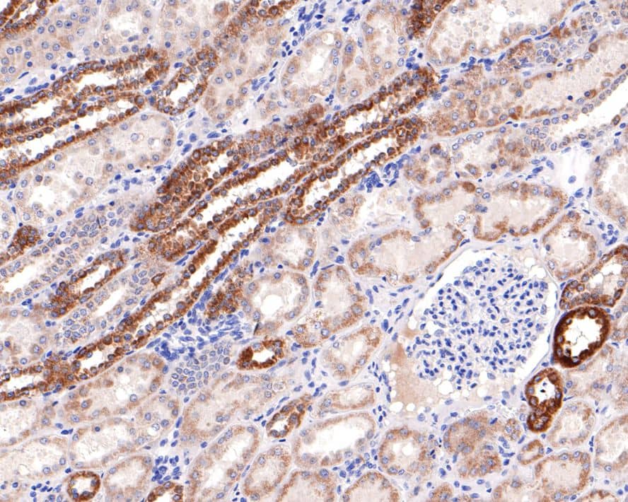 UIP1 Antibody (JE65-32)