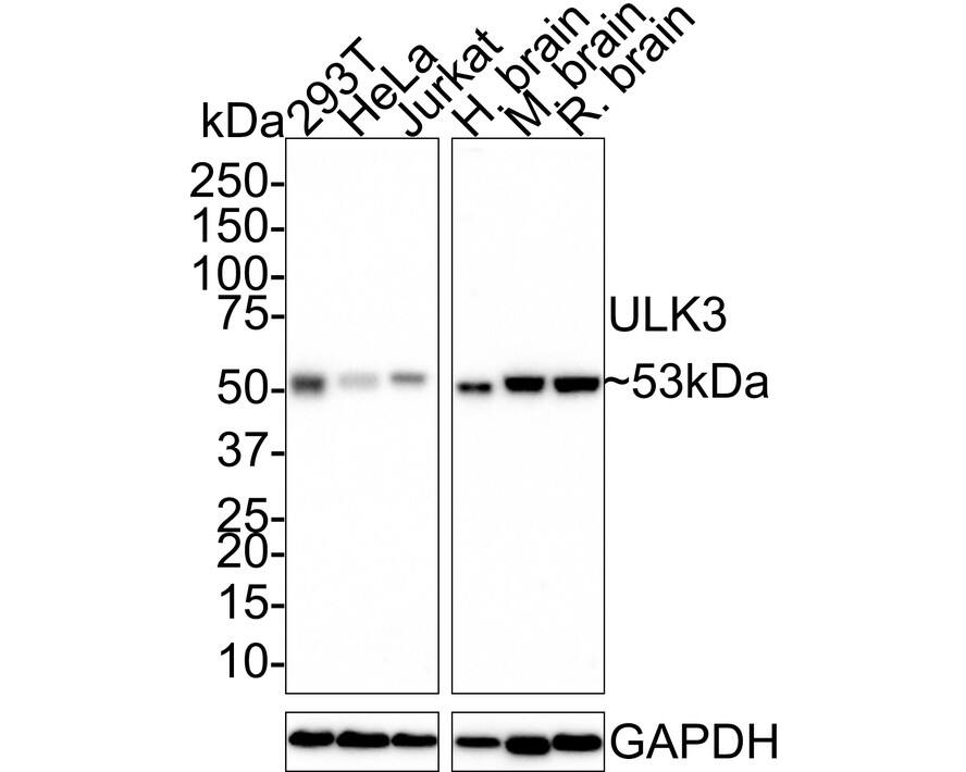 ULK3 Antibody (PSH01-09)