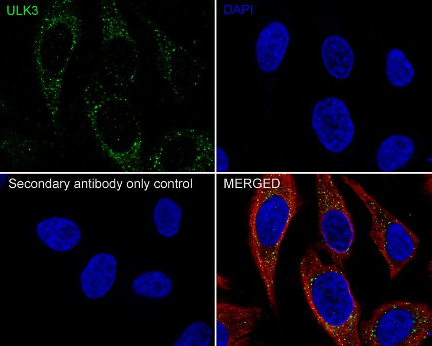 ULK3 Antibody (PSH01-09)