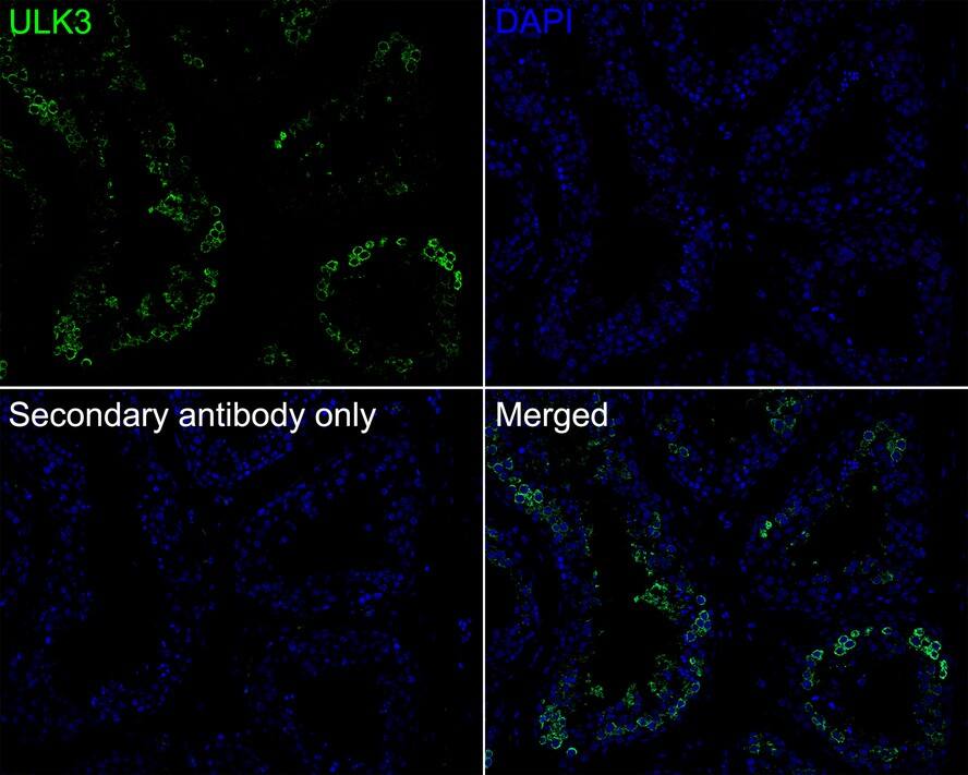 ULK3 Antibody (PSH01-09)