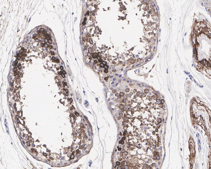 ULK3 Antibody (PSH01-09)