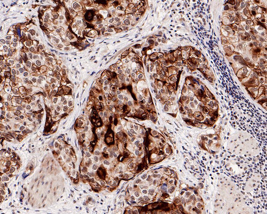 Uroplakin III Antibody (PD00-09)