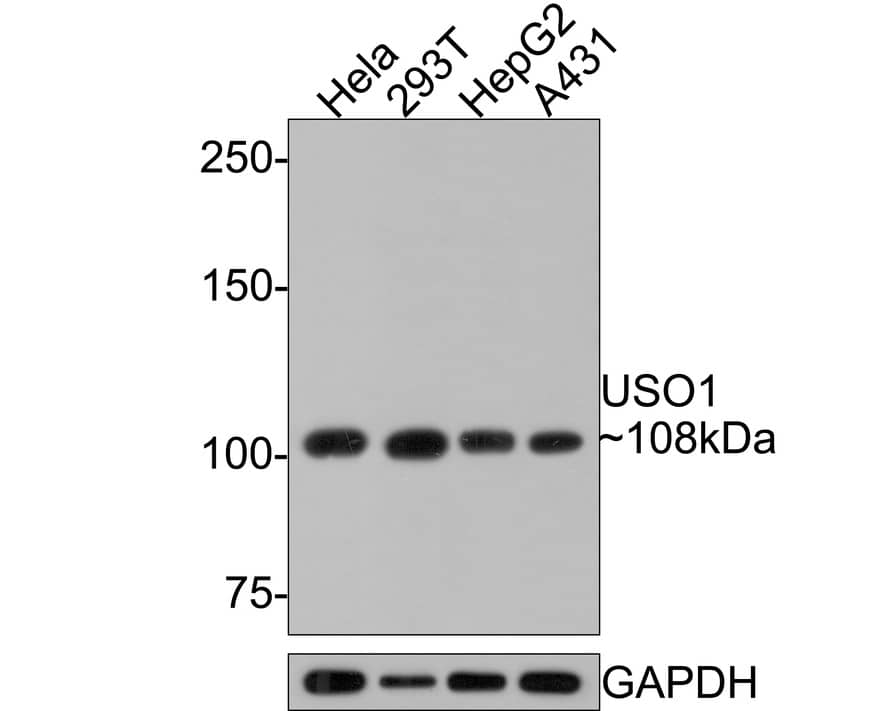 VDP p115 Antibody (JE64-48)