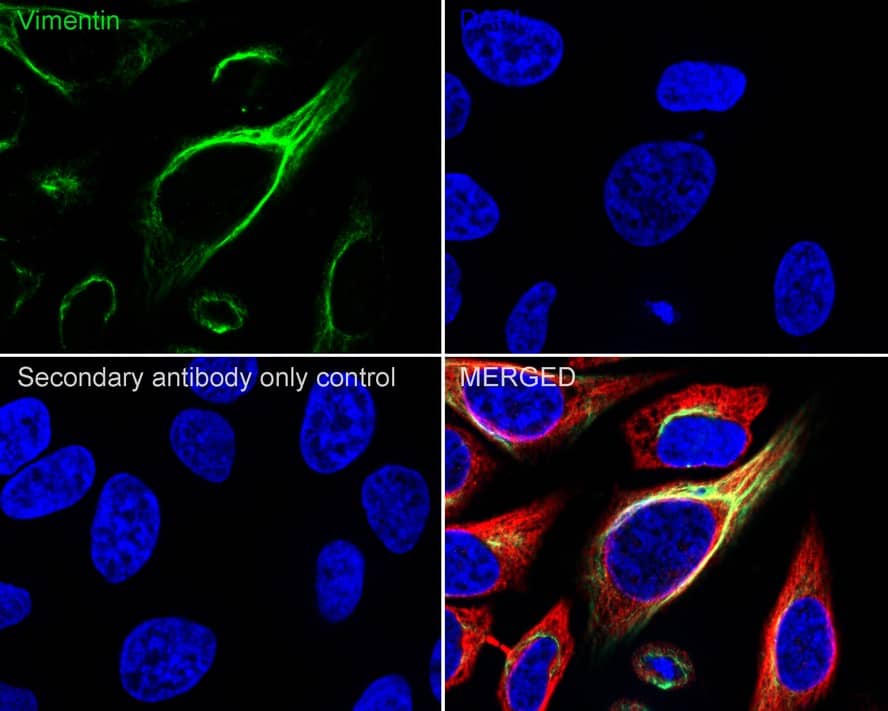Vimentin Antibody (A6-C1-R)