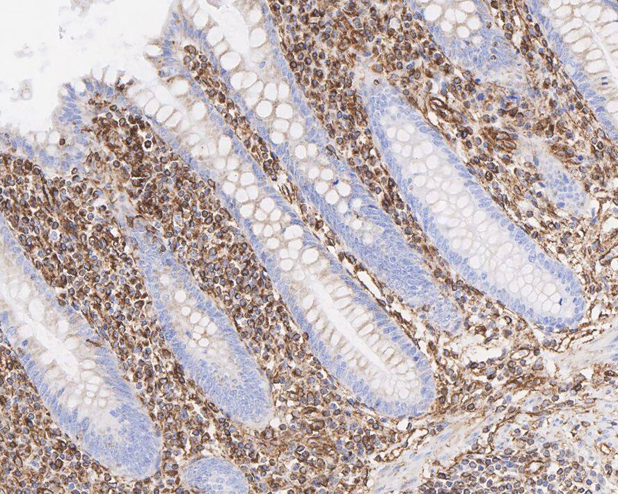 Vimentin Antibody (A6-C1-R)