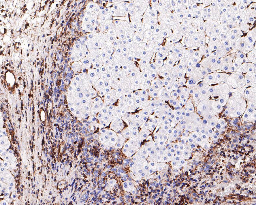 Vimentin Antibody (PDH0-01)