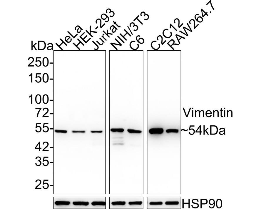 Vimentin Antibody (SC60-05) Western Blot: Vimentin Antibody (SC60-05) [NBP3-33094]