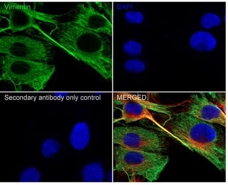 Vimentin Antibody (SC60-05)
