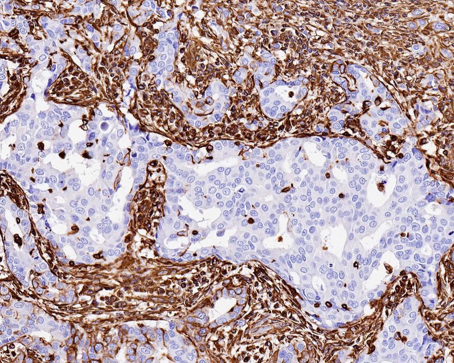 Vimentin Antibody (SC60-05)