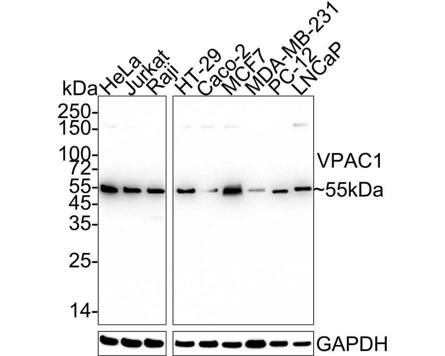 VIPR1/VPAC1 Antibody (PD00-96)